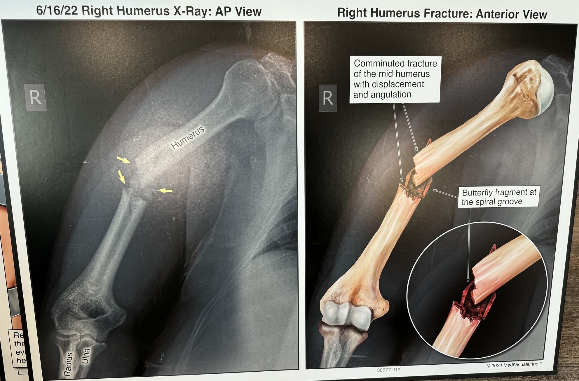 trial exhibit of client's injuries